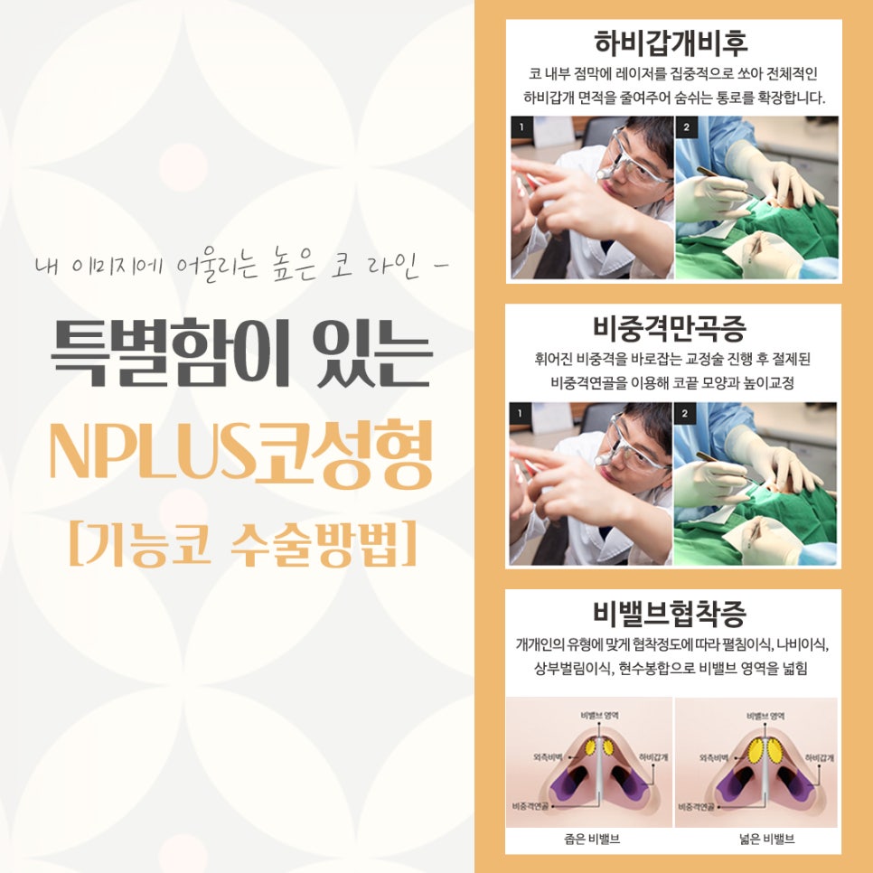 If You’re Looking for a Place That Does Rhinoplasty Well! image 10