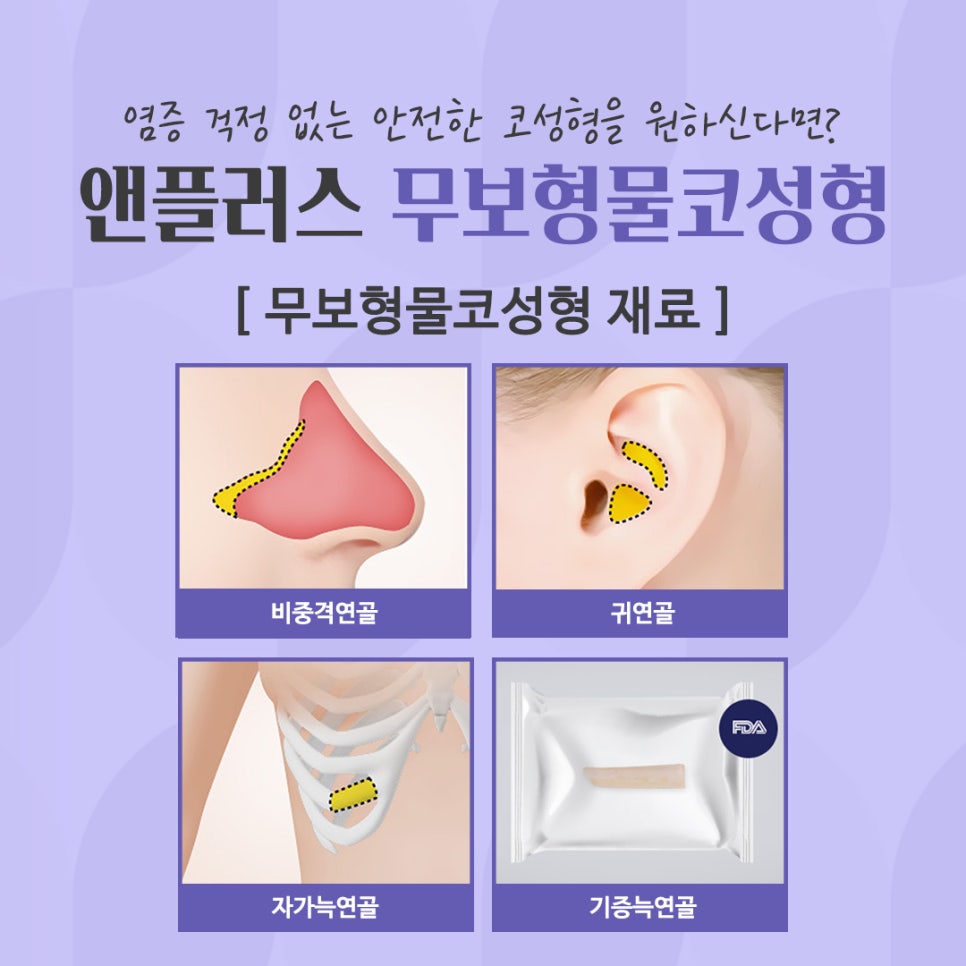 무보형물코성형 자가연골 활용으로 안전하게 관련 이미지 7