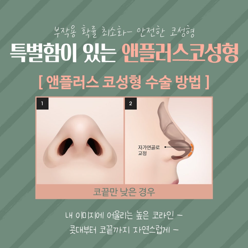 Beautiful and Natural with Autologous Cartilage Rhinoplasty image 10