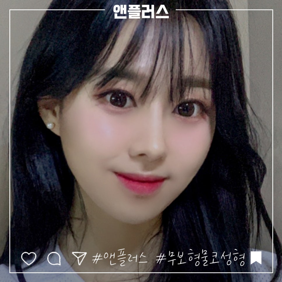 무보형물코수술 자연스러운 코 라인을 원한다면! 관련 이미지 3
