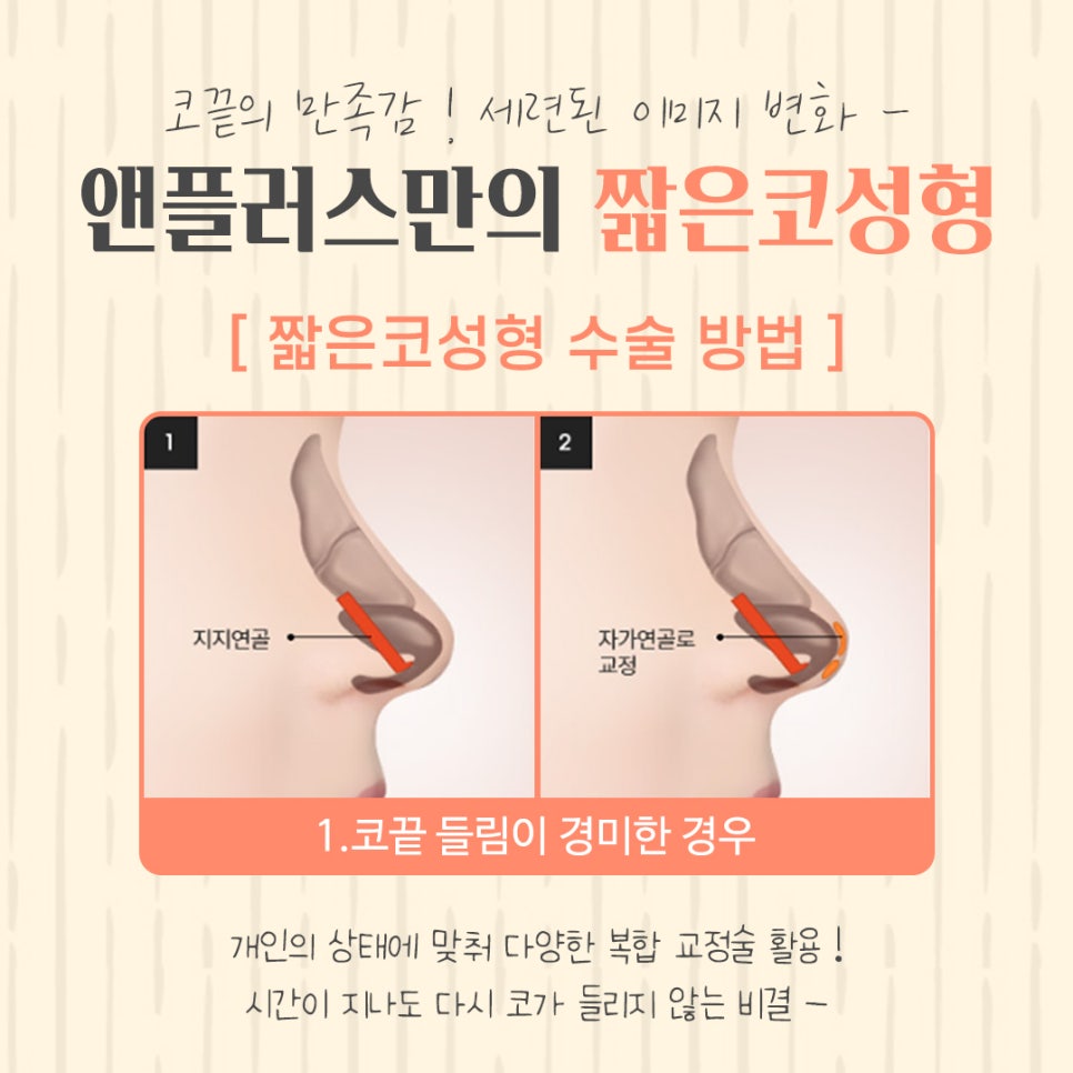 짧은코수술에 대한 정보를 찾는다면 관련 이미지 10