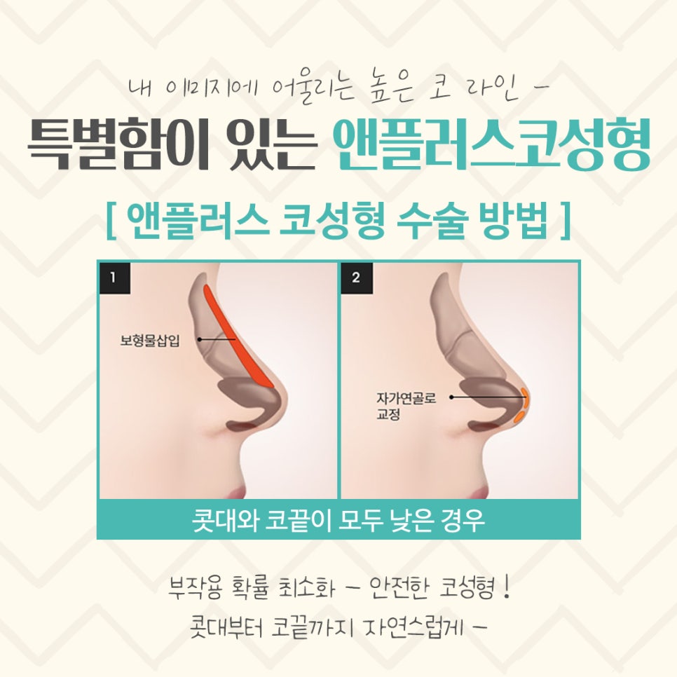 코수술후기 자세하게 알아보고 판단 관련 이미지 7