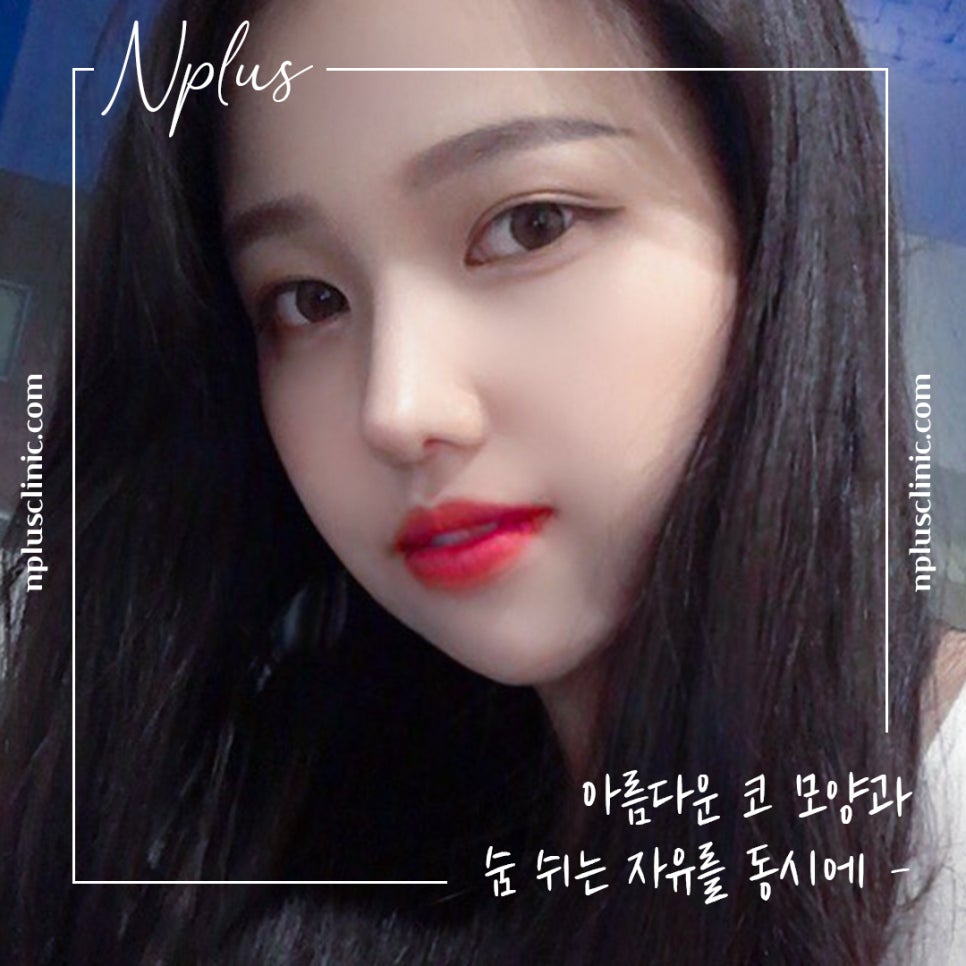 자가늑연골코성형으로 세련된 이미지로 변신 관련 이미지 1