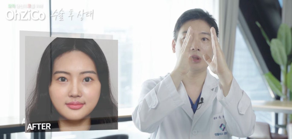 짧은코수술 후기까지 자세하게 알아보고 관련 이미지 10