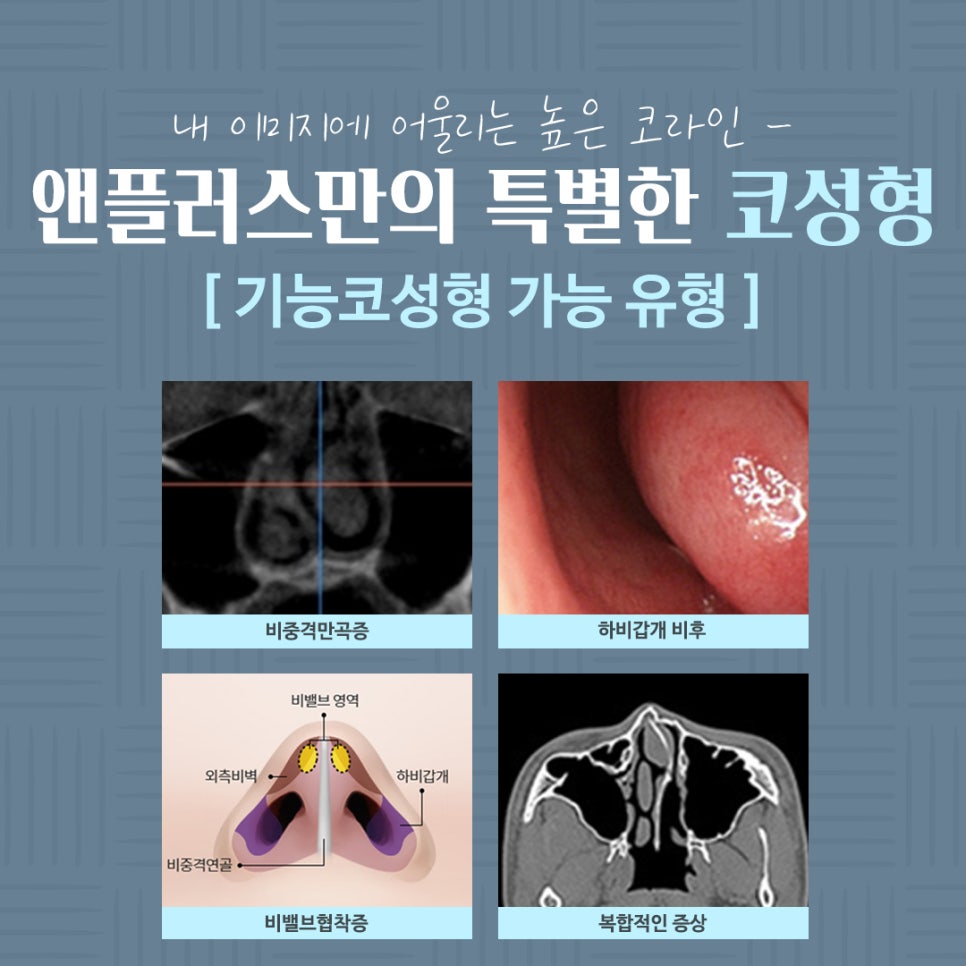 코수술전후 기능까지 확인하고 관련 이미지 11
