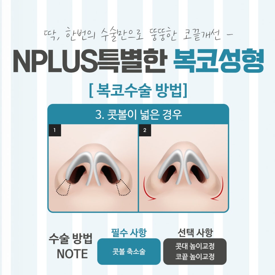 Looking Closely at Bulbous Nose Surgery Reviews image 10