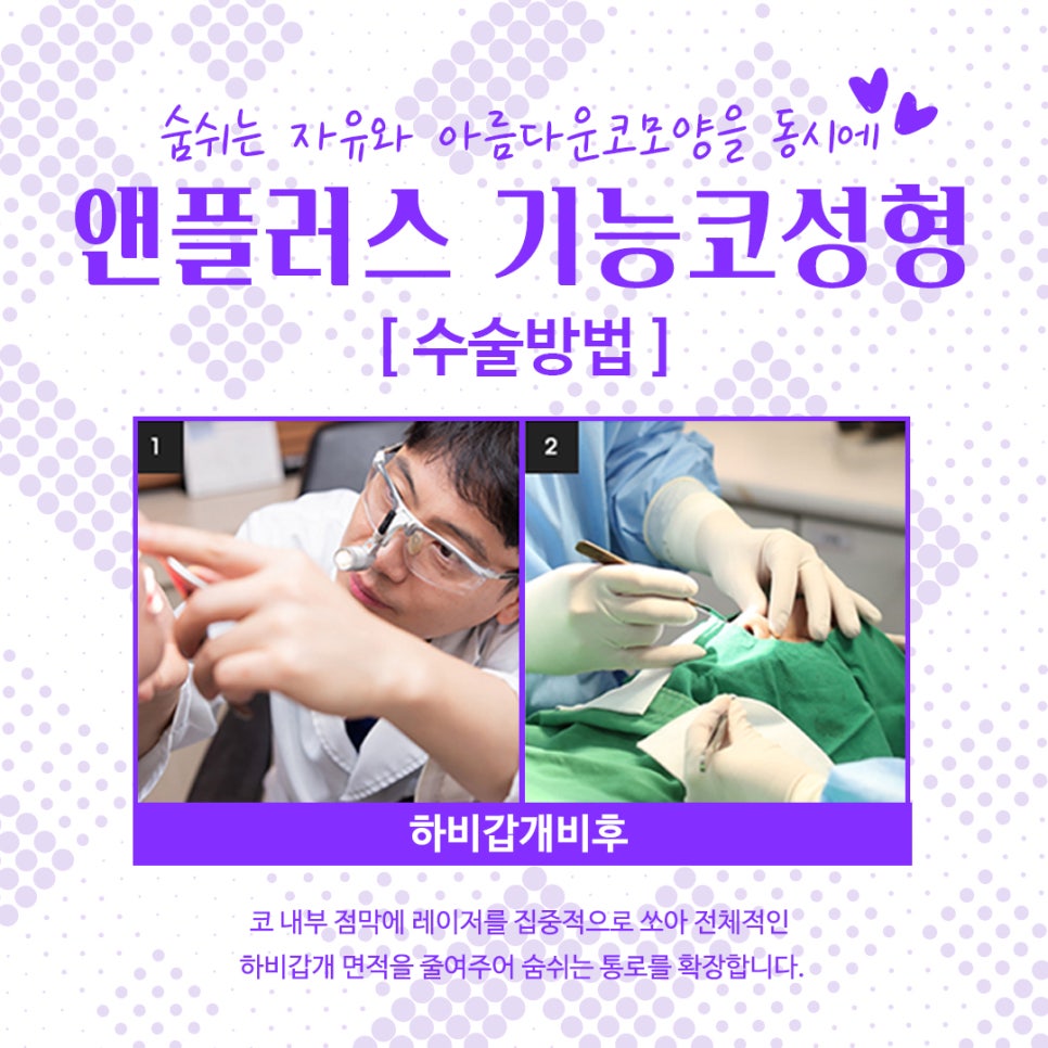 Nose Surgery Review from Anplus Plastic Surgery image 8