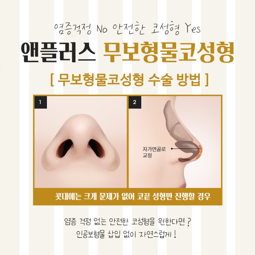 무보형물코수술후기 다양한 내용을 알아보고 관련 이미지 7