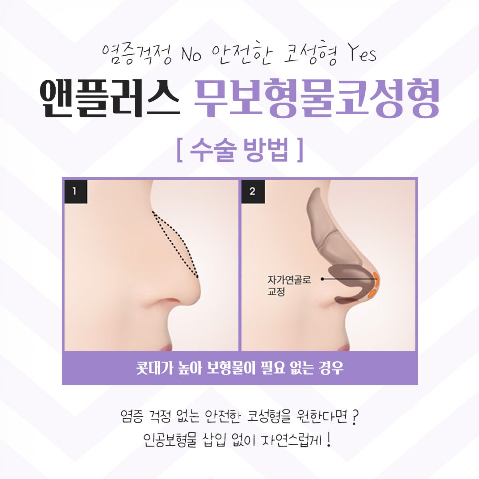 Learn More in Detail About Reviews of Nose Surgery Without Implants image 10