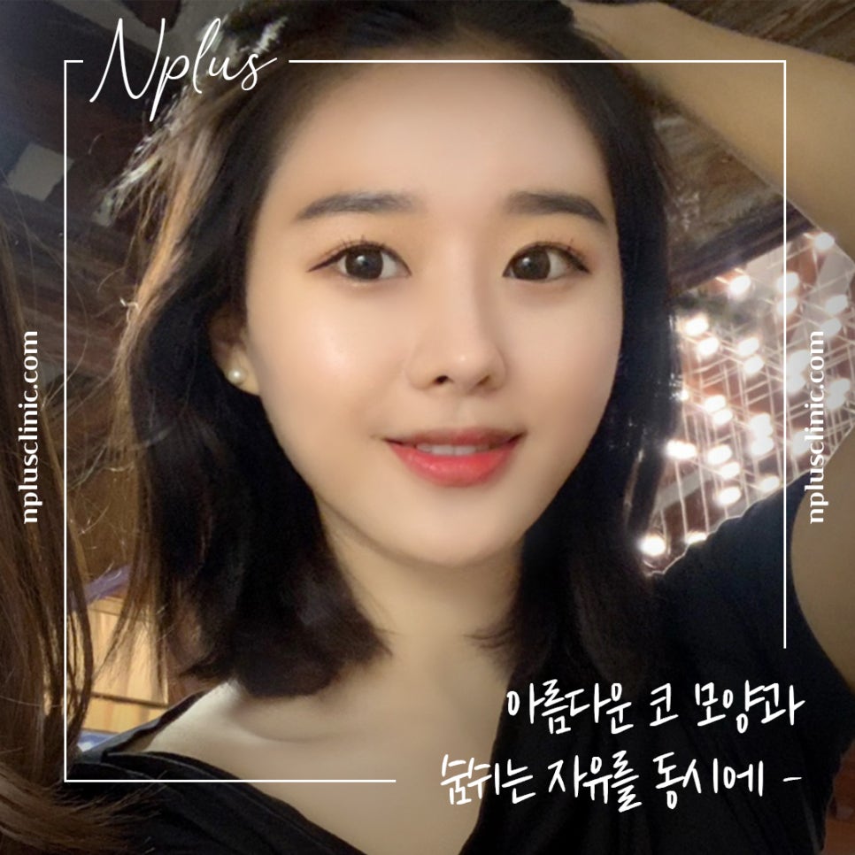 화살코수술 후기까지 알아보고 결정 관련 이미지 2