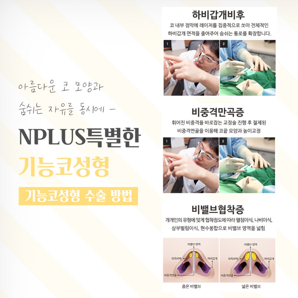 If You’re Looking for Functional Nose Surgery Reviews image 9