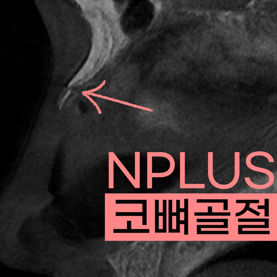 Nose Bone Fracture Emergency Consultation! Inquiries Available on Weekends/Holidays★ image 1