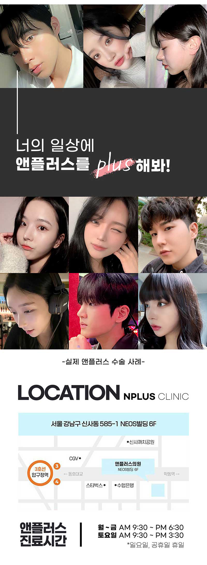 앤플러스의원 코재수술이벤트로 자연스럽고 예쁘게- 관련 이미지 9