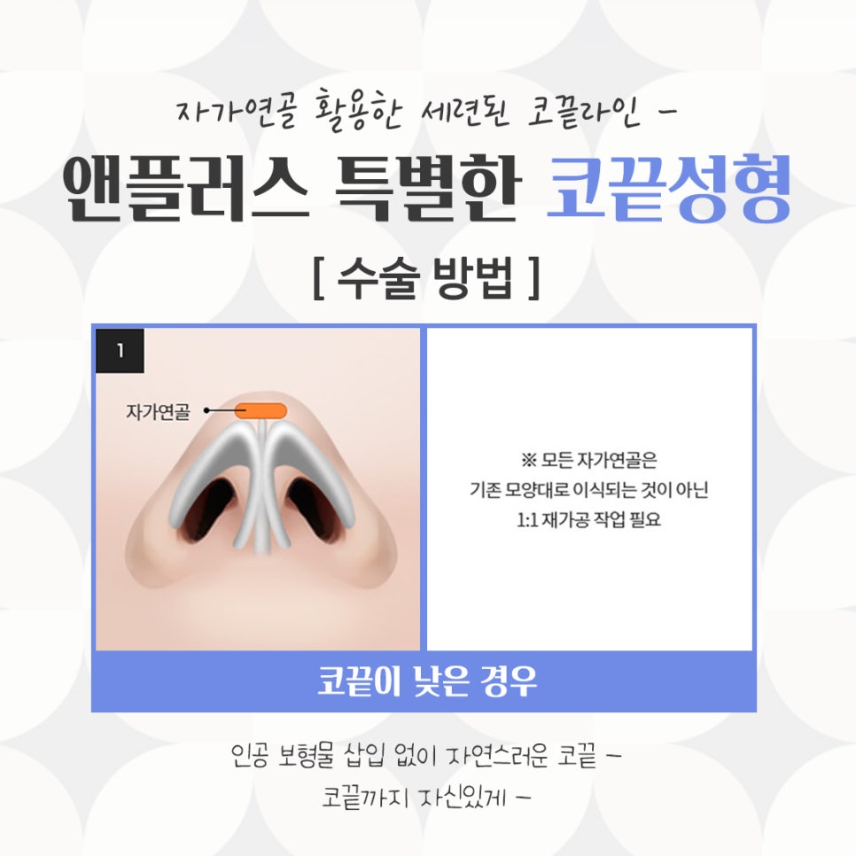 코끝수술에 대해 알아보고 신중하게 관련 이미지 7