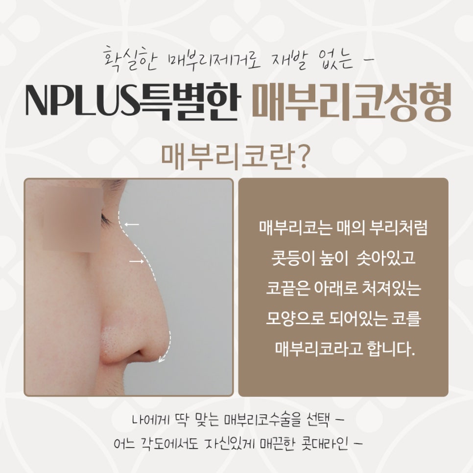 Checking a Hump Nose Surgery Review in Various Ways image 3