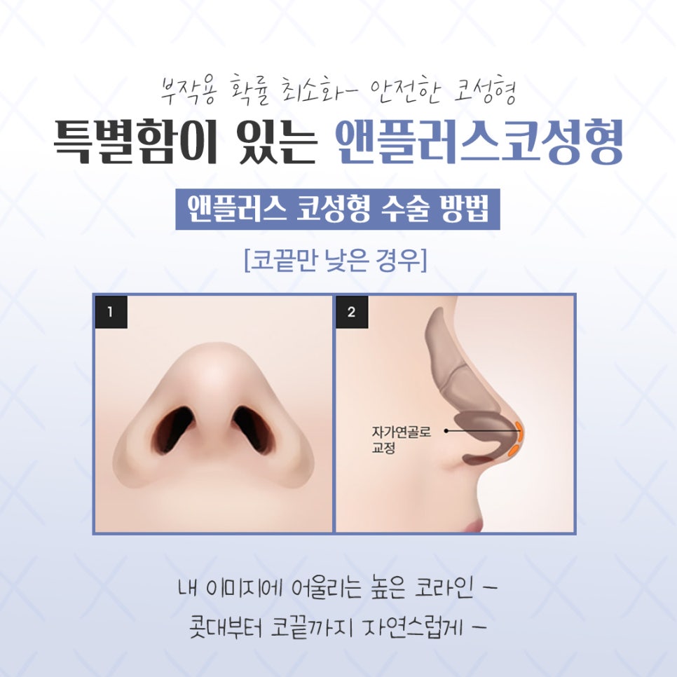 코성형전후 개선할 점을 확인하고 관련 이미지 10