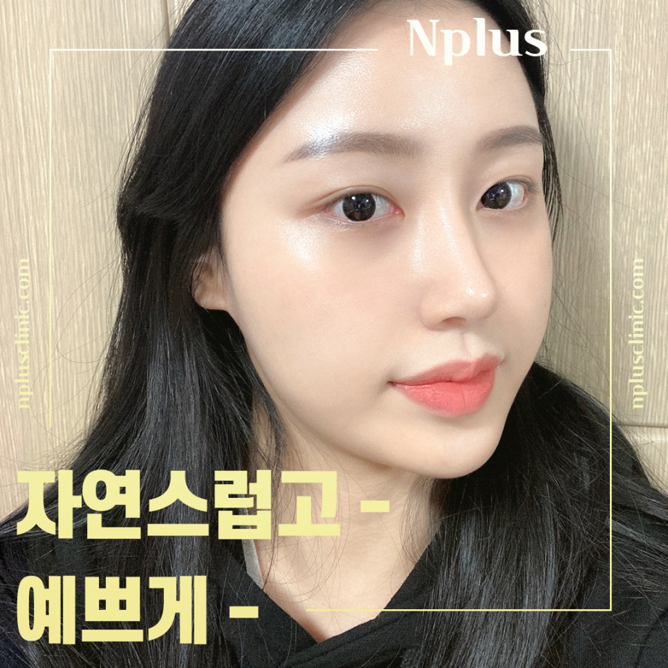 Creating a More Three-Dimensional Look with Low Nose Surgery image 4
