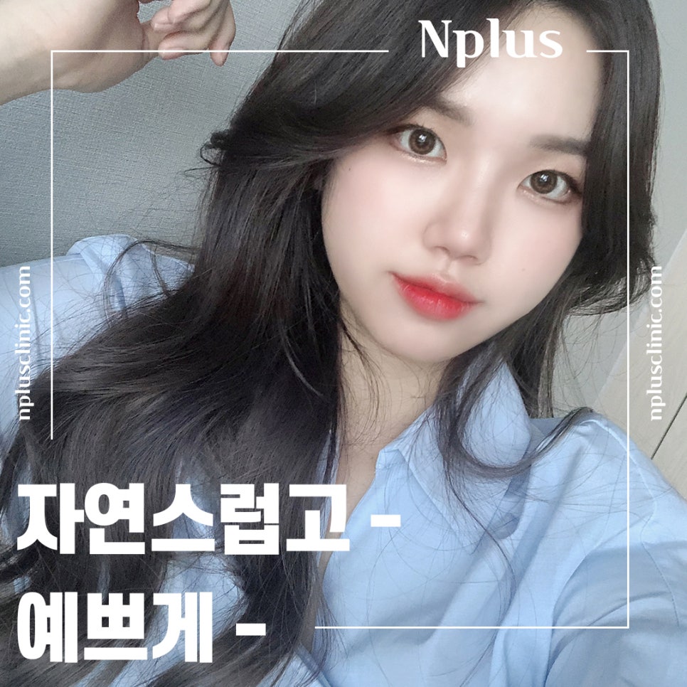 Rhinoplasty Review: Improved with a Refined Line image 14