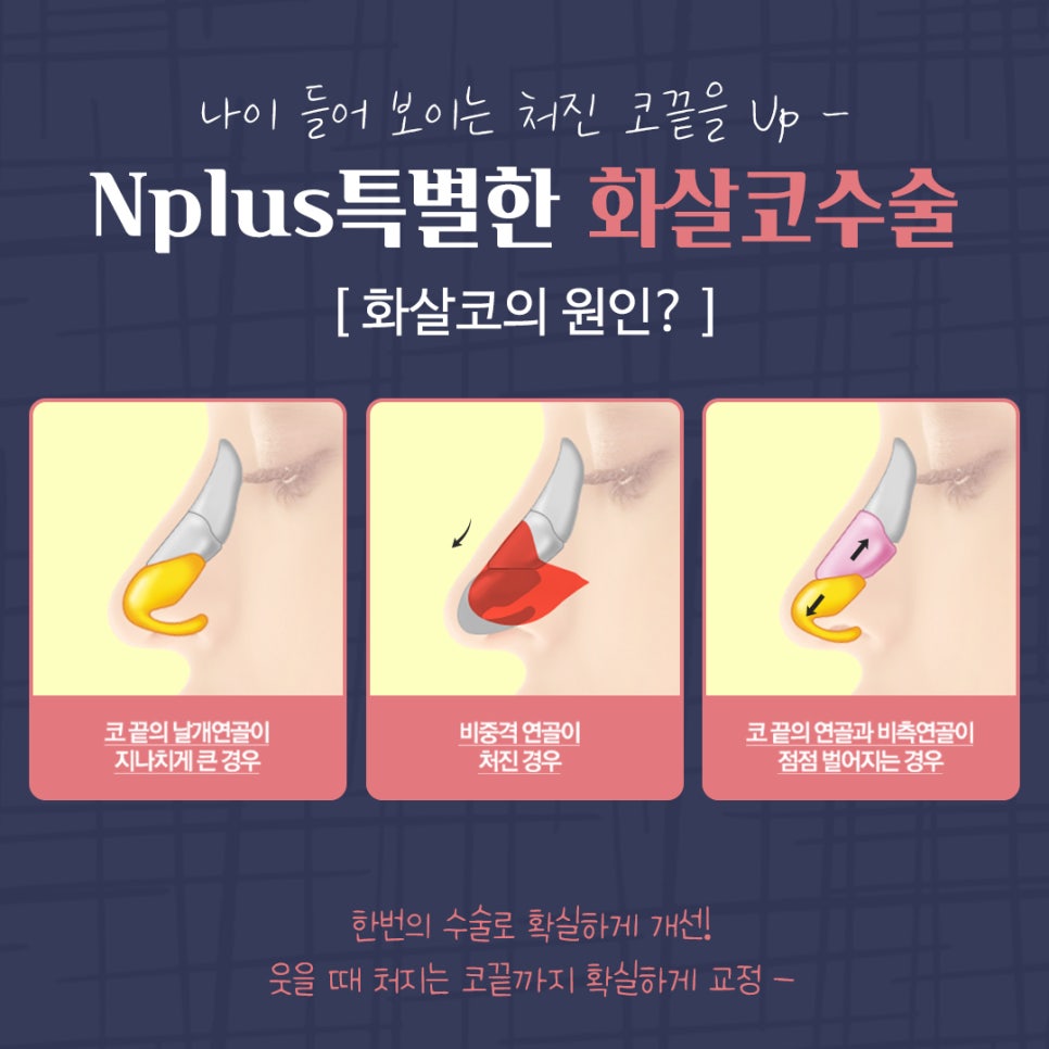 Transforming Your Look to a More Youthful Appearance After Arrow Nose Surgery image 4