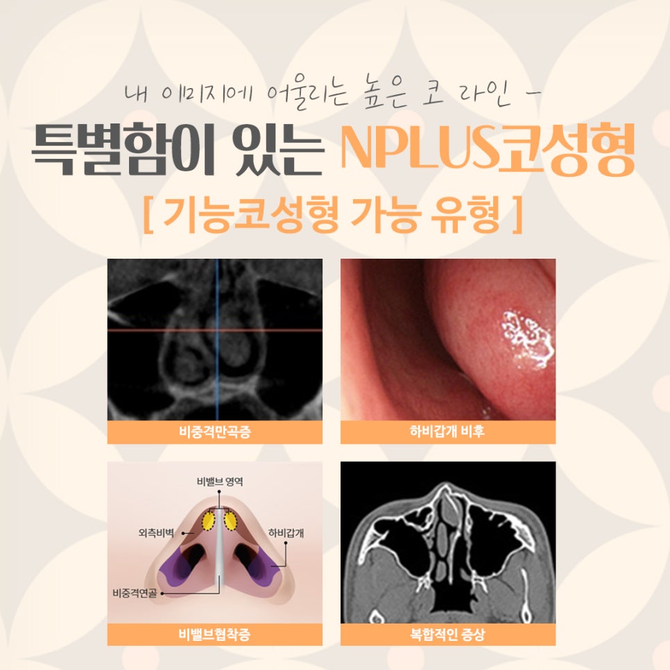 서울성형외과에서 알아본 코수술후기 관련 이미지 5