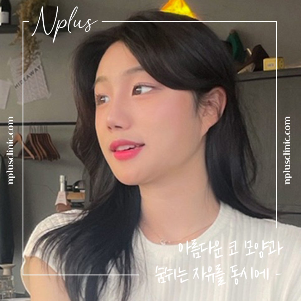 Natural Progress in Nasal Alar Reduction Surgery Review image 1