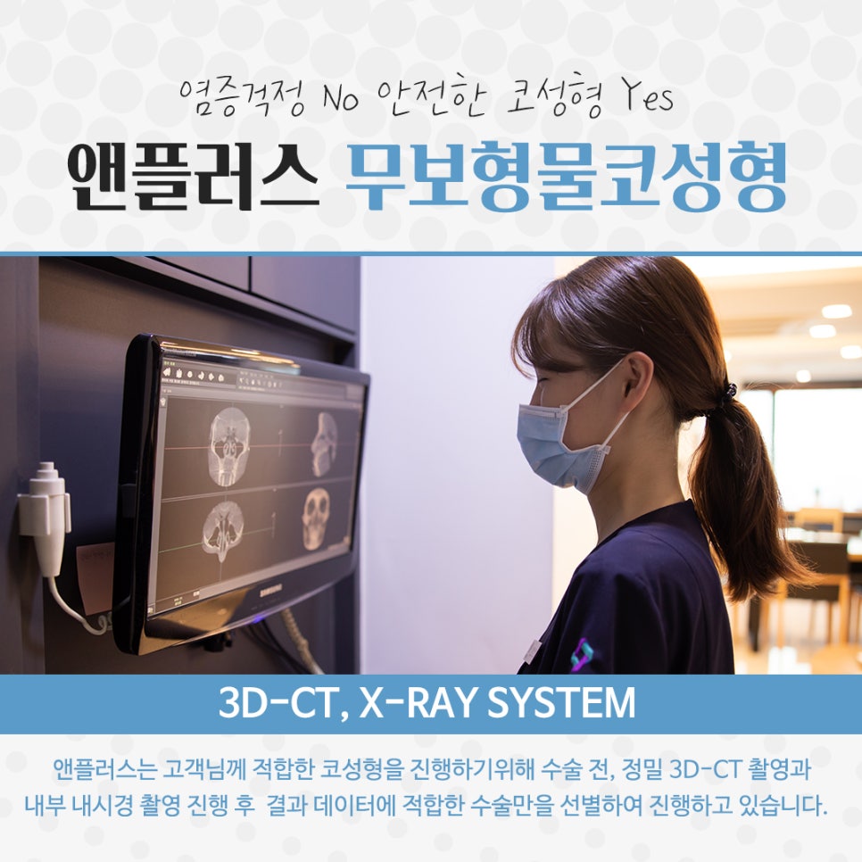 Non-Implant Rhinoplasty: Natural and Safe image 5