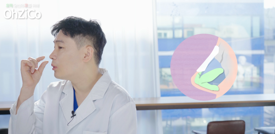 Pros and Cons of Autologous Rib Cartilage and Donor Rib Cartilage! image 2