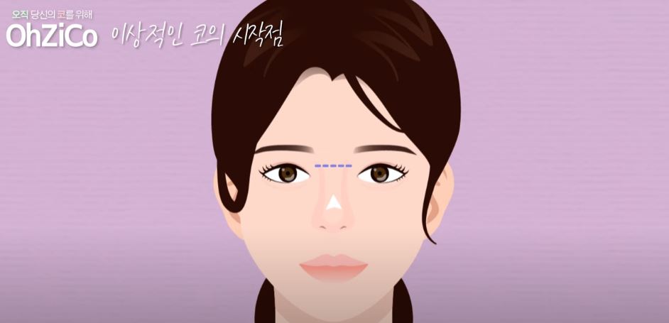 코성형 후 눈몰림 걱정된다면? 관련 이미지 20