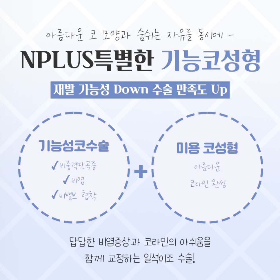 기능코성형 후기 보고 비교하여 관련 이미지 3