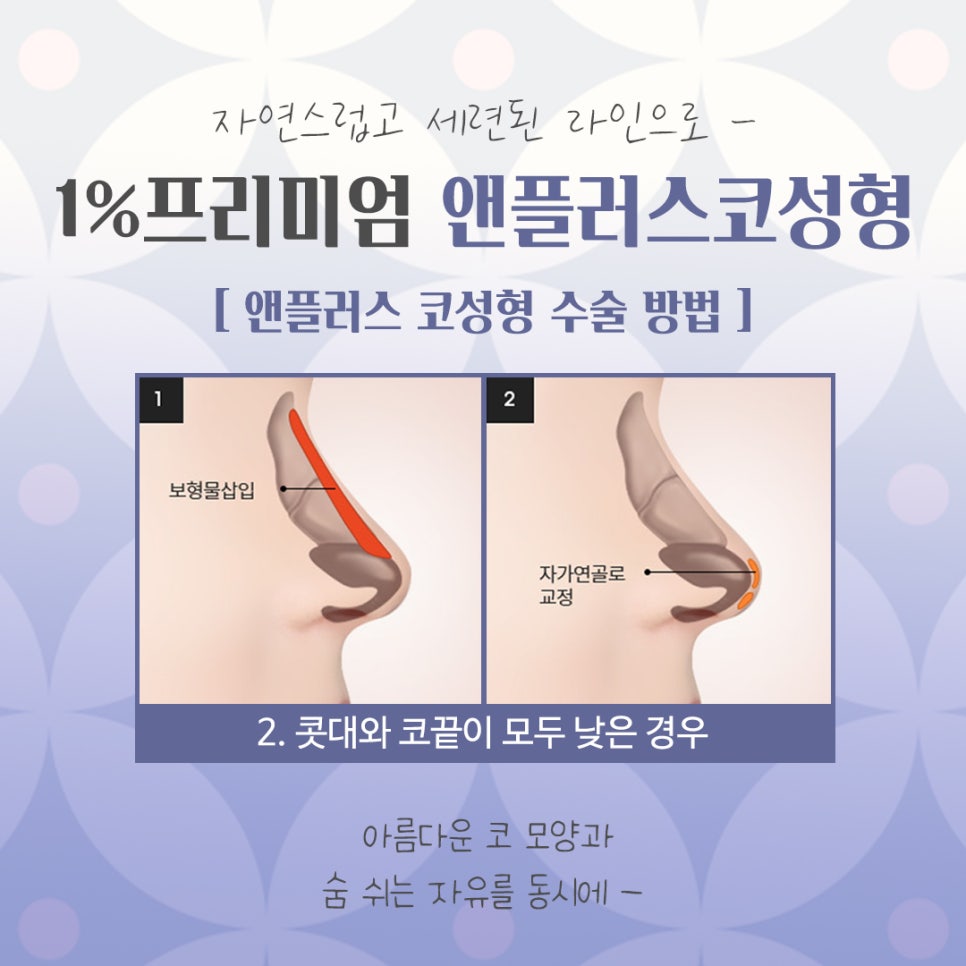자가늑코수술 내게 어울리는 라인으로 관련 이미지 9