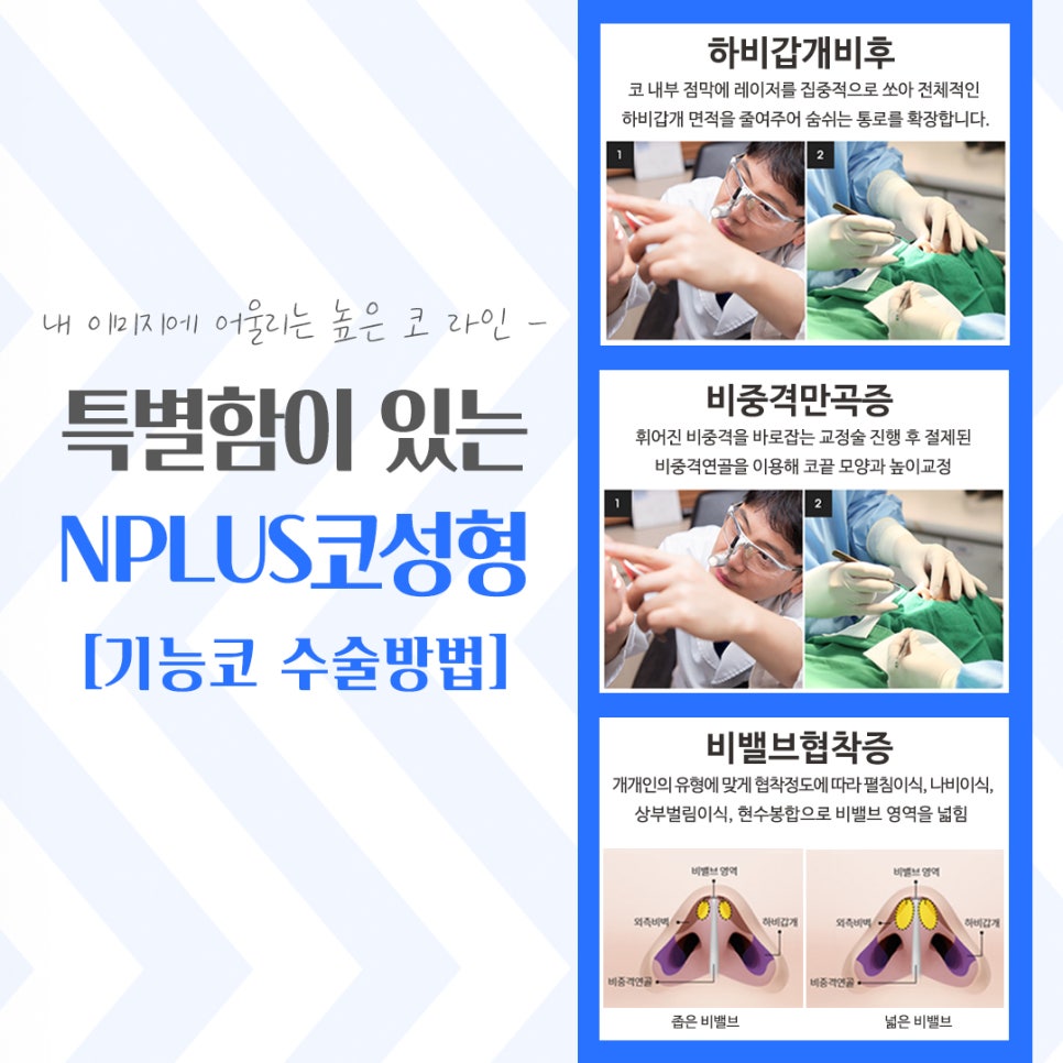 Learn More at a Place Known for Rhinoplasty image 9