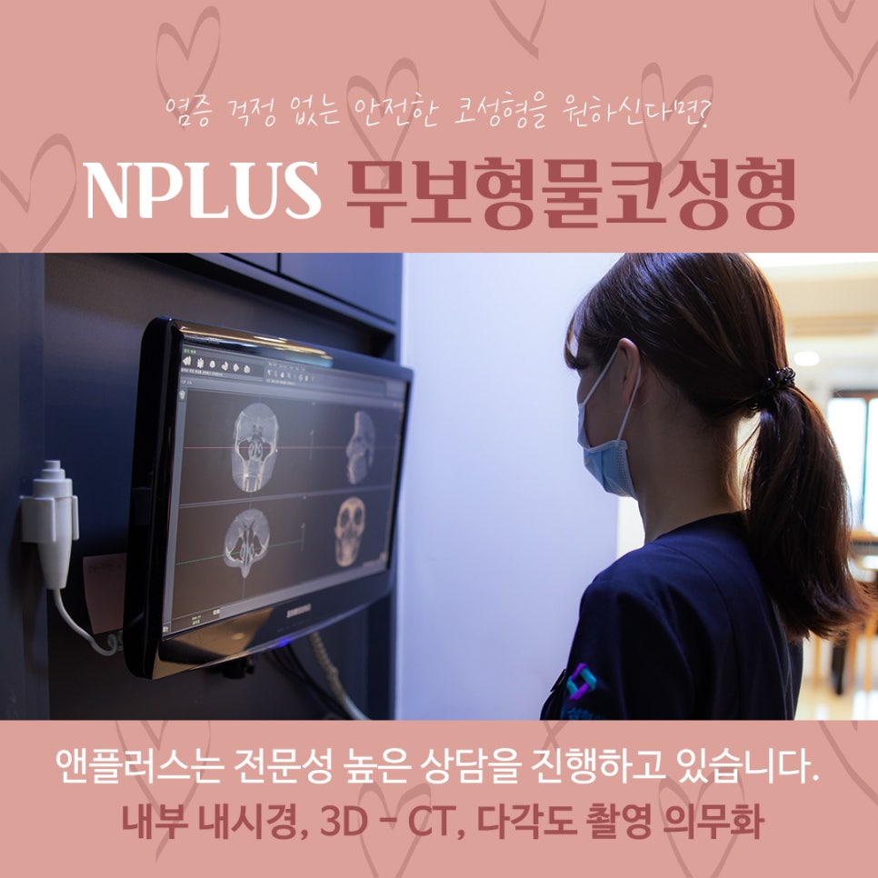 무보형물코수술후기 자연스러운 코라인으로 관련 이미지 10