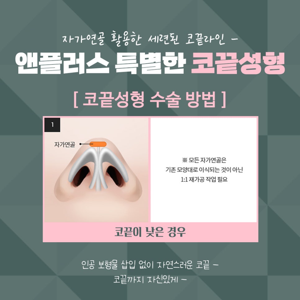 Nasal Tip Surgery Review Using Autologous Cartilage image 8