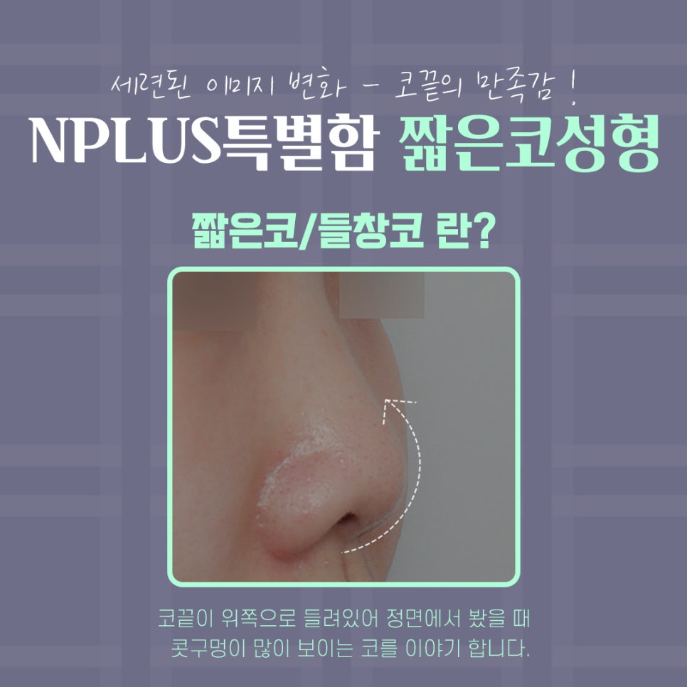 짧은코성형 후기를 보고 개선된 점 알아보기 관련 이미지 4