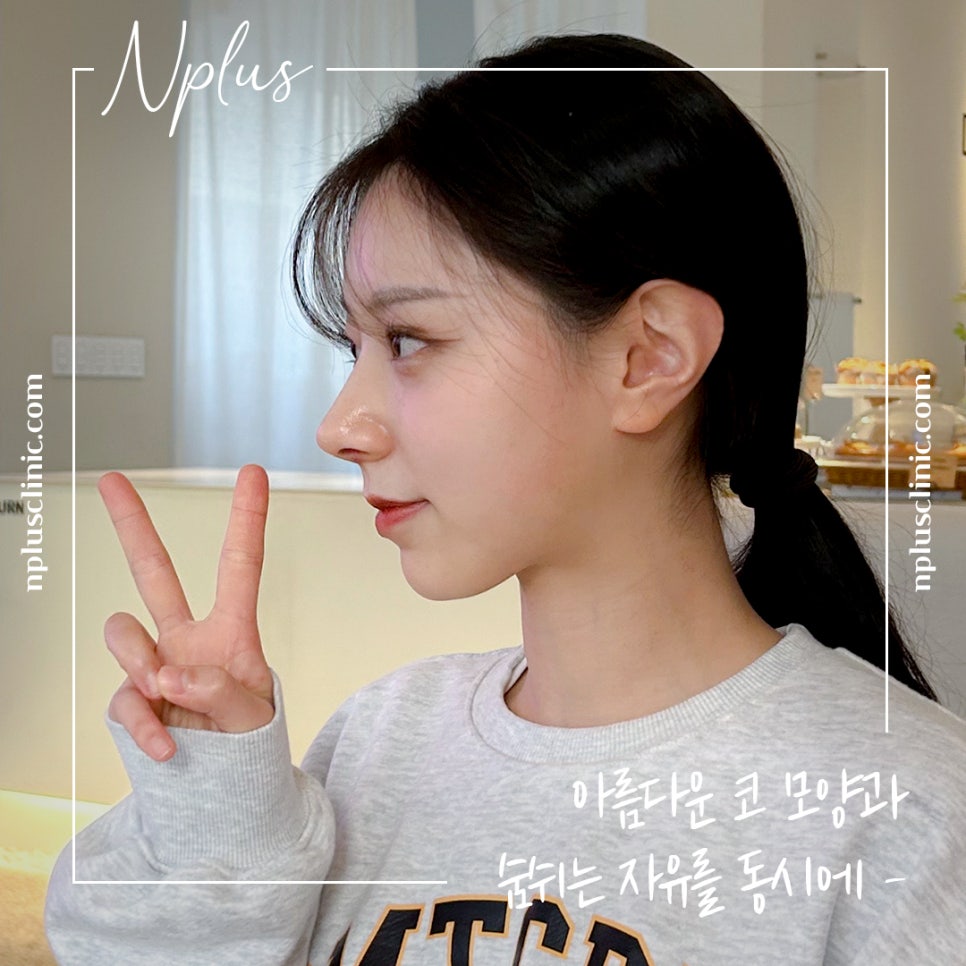 코수술후기를 통해 내게 어울리는 라인으로 관련 이미지 1