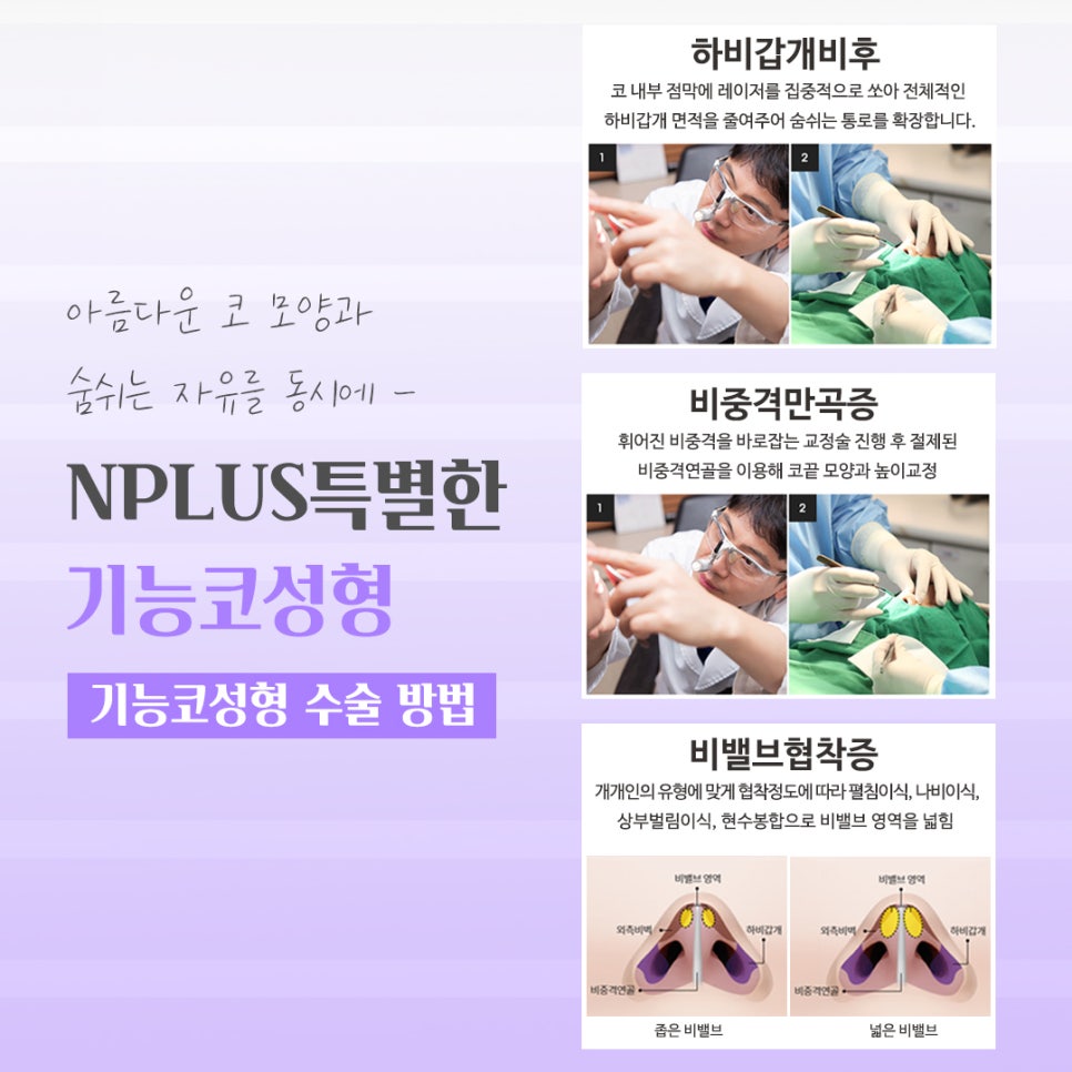 기능코성형후기에 대한 체크리스트 관련 이미지 9