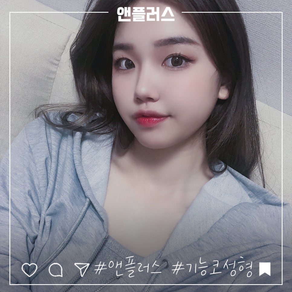 코성형후기 만족스러운 결과 관련 이미지 3
