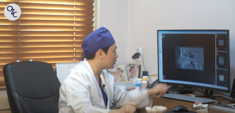 AN Plus Plastic Surgery Review: Silicone Nasal Bridge, Autologous Rib Cartilage Nasal Tip, Under-Eye Fat Repositioning, Fat Grafting image 13