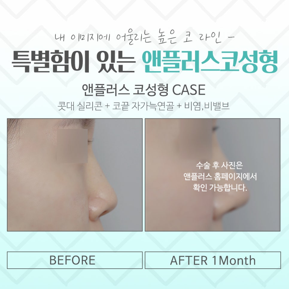 첫코수술 문제를 정확하게 파악하고 관련 이미지 14