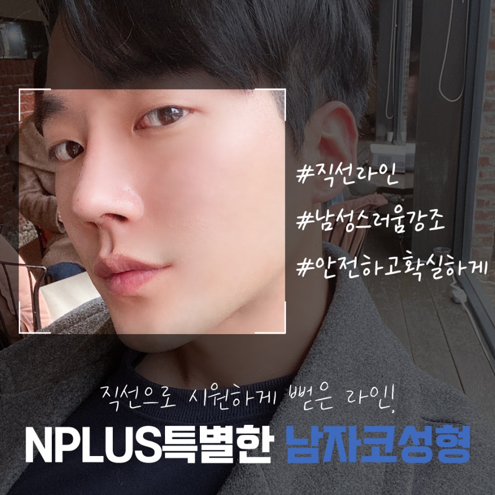 남자비염코성형 자세하게 알아보고 결정 관련 이미지 12