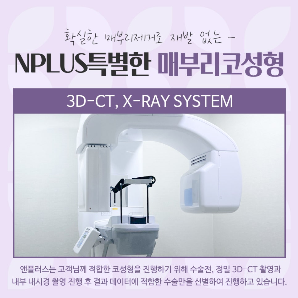 Check the Hump Nose Surgery Review in Detail image 6
