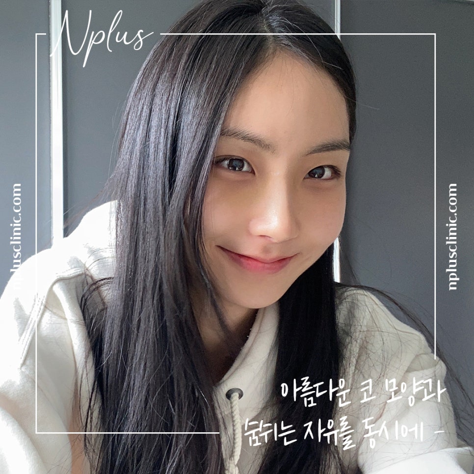 콧볼축소후기 넓은 콧볼이 고민이라면 관련 이미지 4