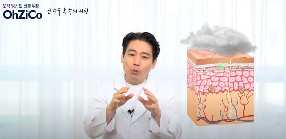 앤플러스에서 전달드리는 코성형주의사항 관련 이미지 7