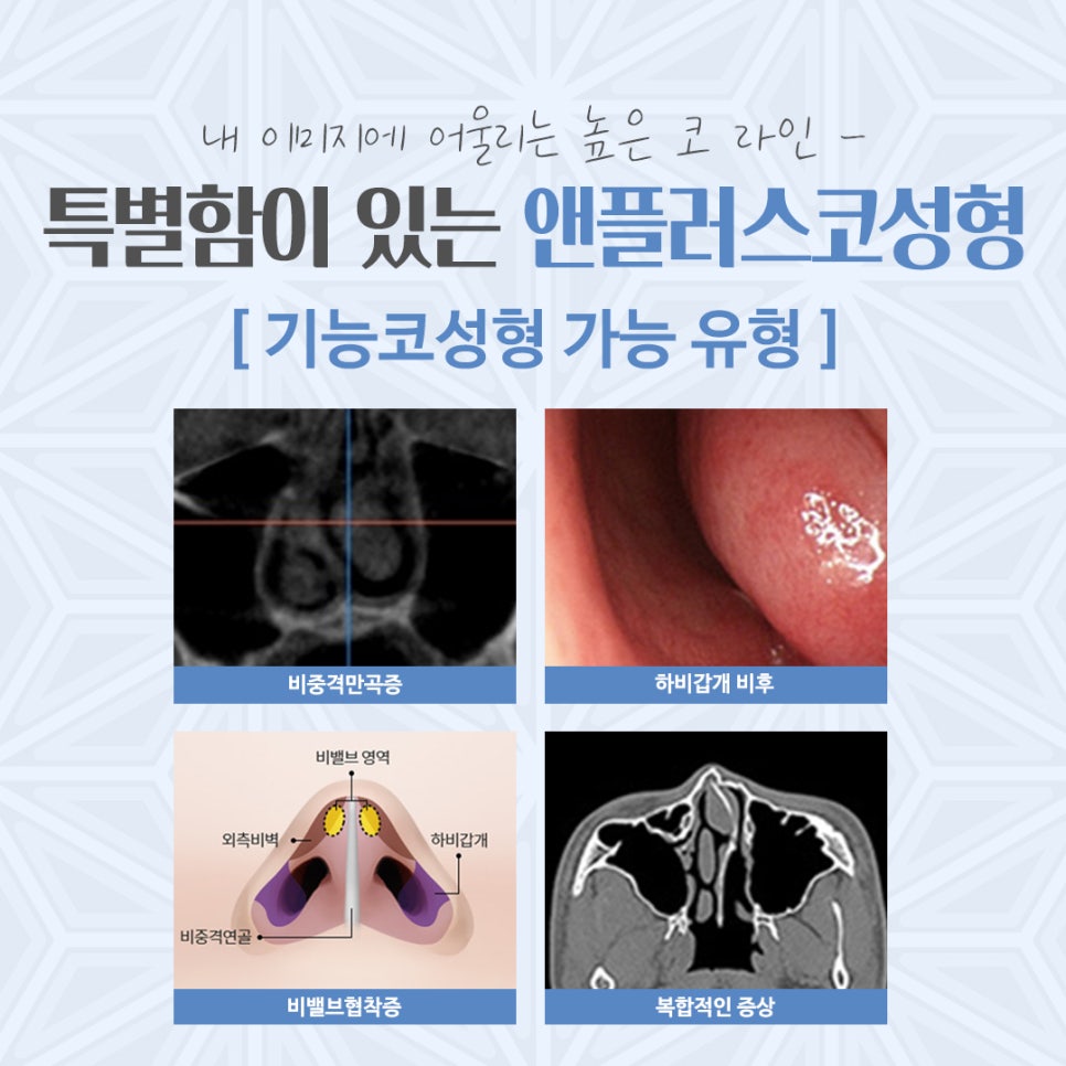 Carefully Reviewing Rhinoplasty Costs image 5