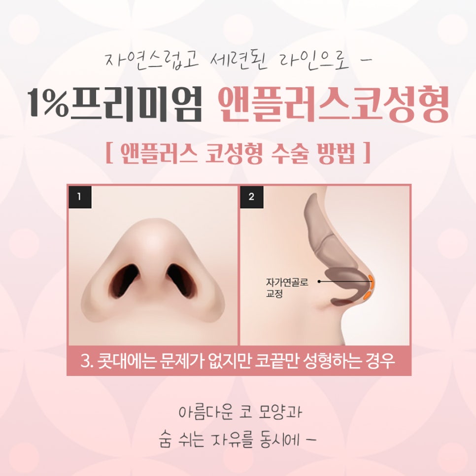 If You Want to Learn About Autologous Rib Cartilage Nose Surgery Accurately image 10