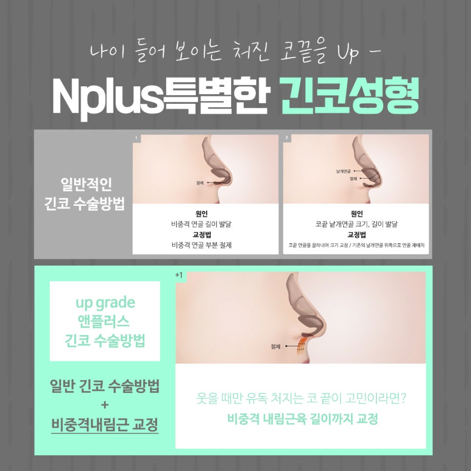 긴코수술 후기까지 확인하고 선택 관련 이미지 9
