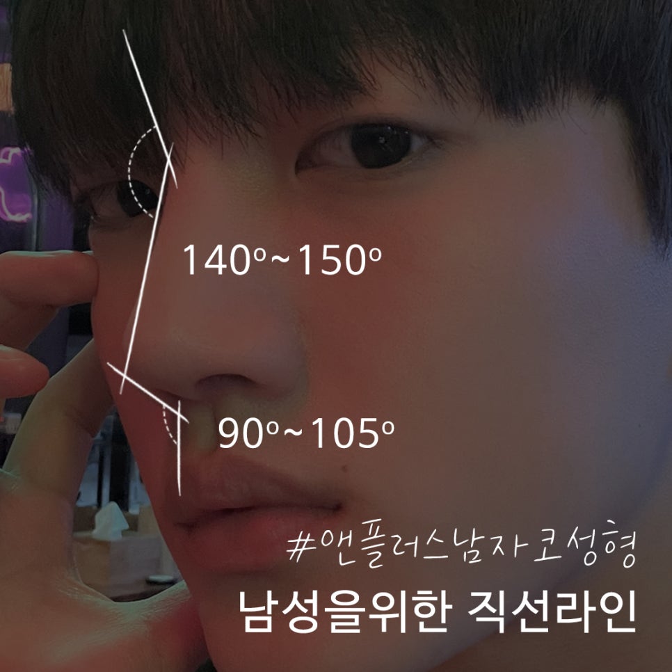 Learn About Before and After Male Nose Surgery in Various Ways image 5
