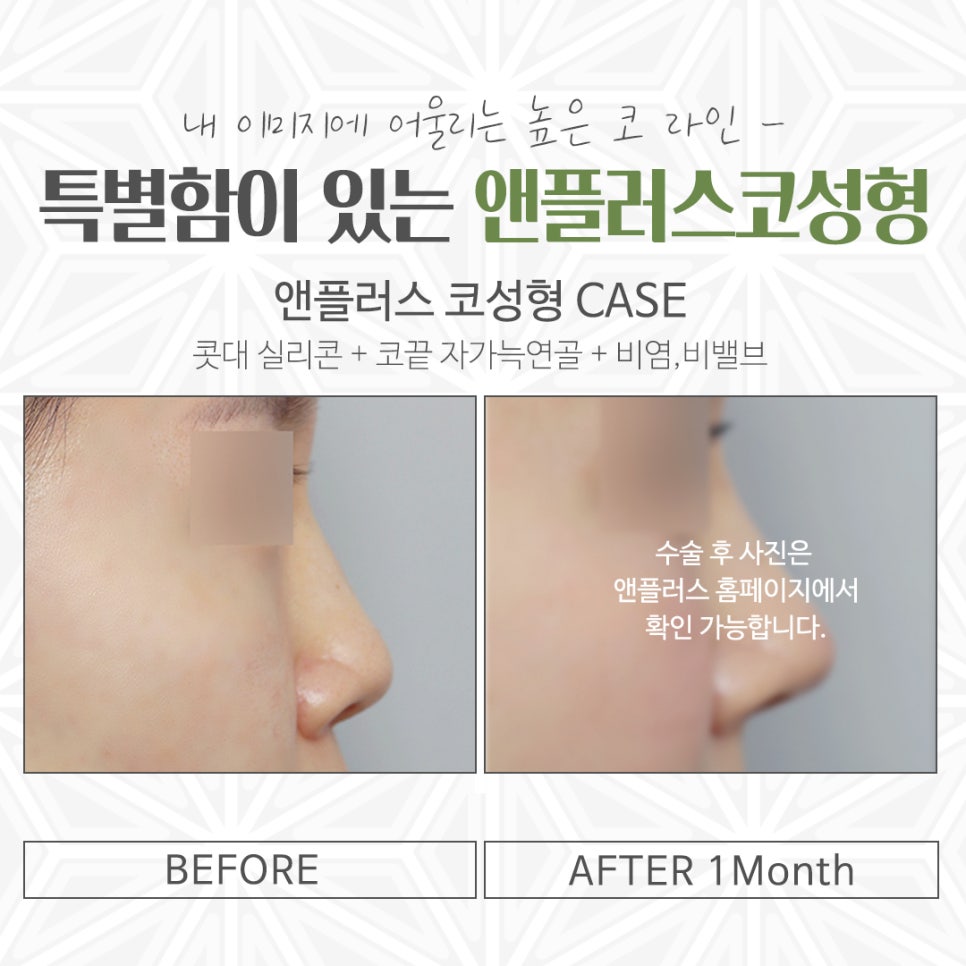 Make Sure to Review Rhinoplasty Costs Carefully Before Deciding image 13