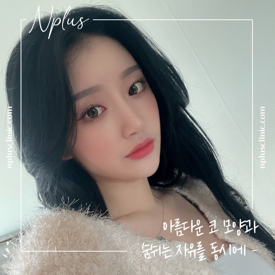 콧볼축소수술후기의 차이를 비교해 보고 관련 이미지 2