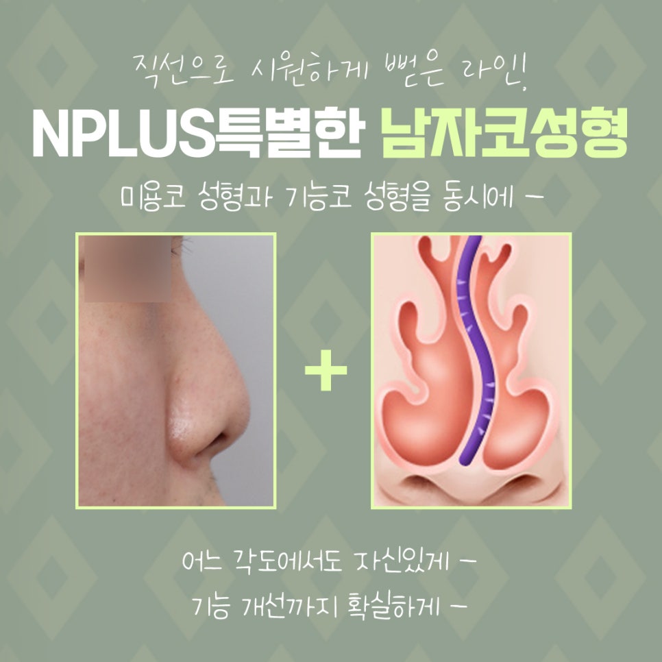 남자코수술후기 정확한 진단으로 관련 이미지 4